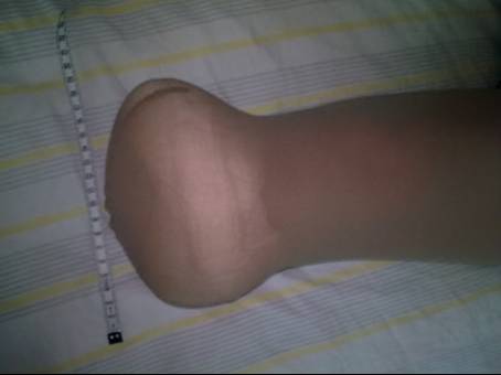 kolbige stumpfform.jpg - 9.71 Kb